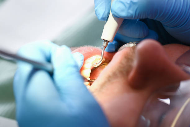 Best Emergency Tooth Extraction  in Park Center, CO